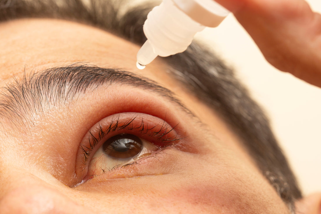 Health Benefits of Castor Oil Eye Drops